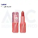 Labial